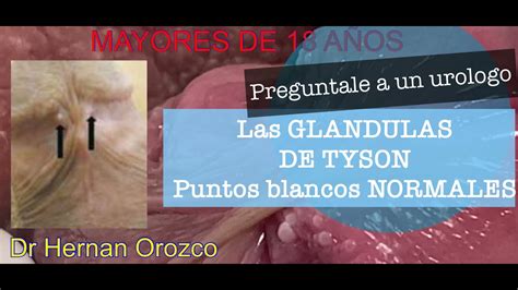 que son glandulas de tyson|Tyson Glands: What They Are, Causes & How to Get。